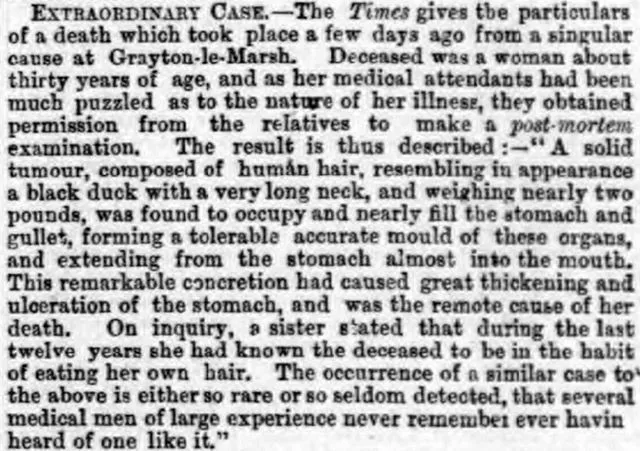 The Liverpool Daily Post reported that a woman had died from eating her own hair in 1869